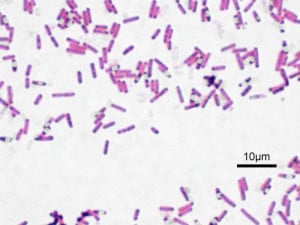 Bacillus_subtilis_Gram-300x225.jpg