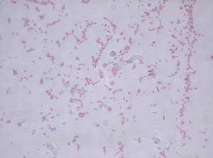 Stenotrophomonas_maltophilia-300x222.jpg