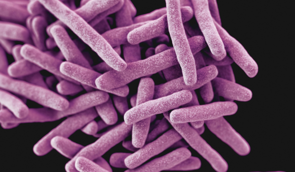 De vanligaste bakterierna i skärvätska - så kan de göra dig sjuk