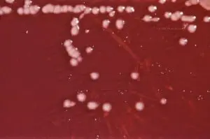 Pseudomonas