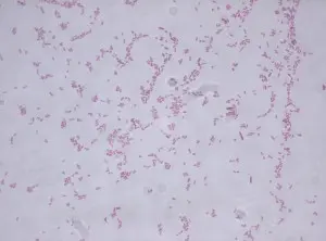 Stenotrophomonas